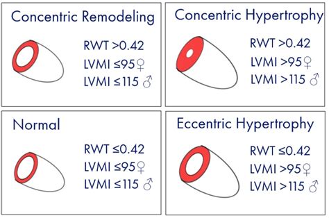 lvmi normal range.